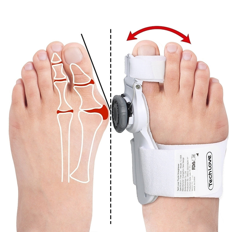 Daily Summit 3D Toe Alignment & Comfort Band (Single – Left or Right)