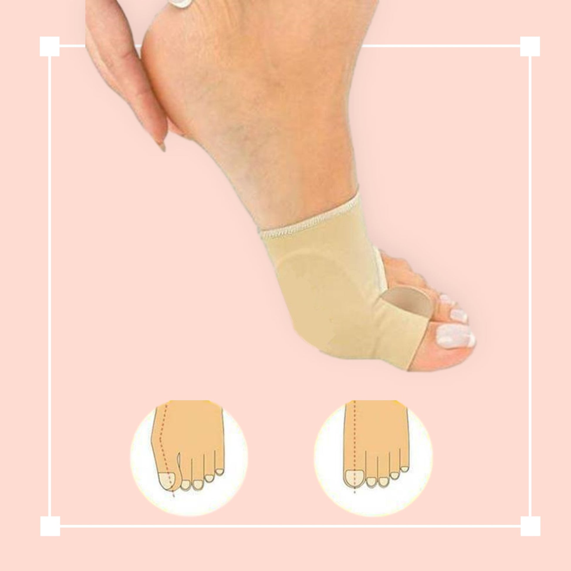 FeelGreat Orthopedic Toe Bunion Corrector - Summit MX Shop