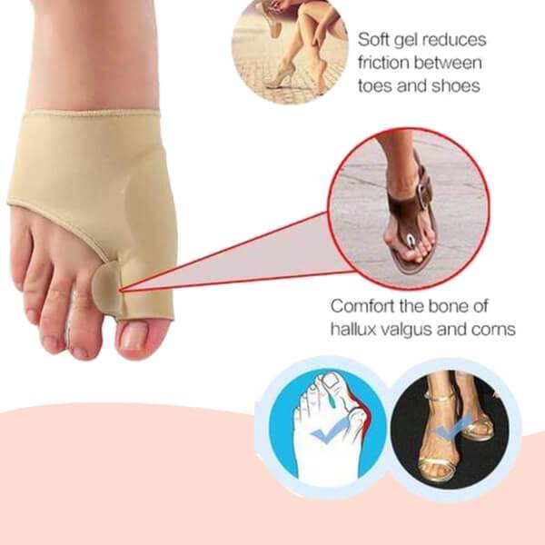 FeelGreat Orthopedic Toe Bunion Corrector - Summit MX Shop