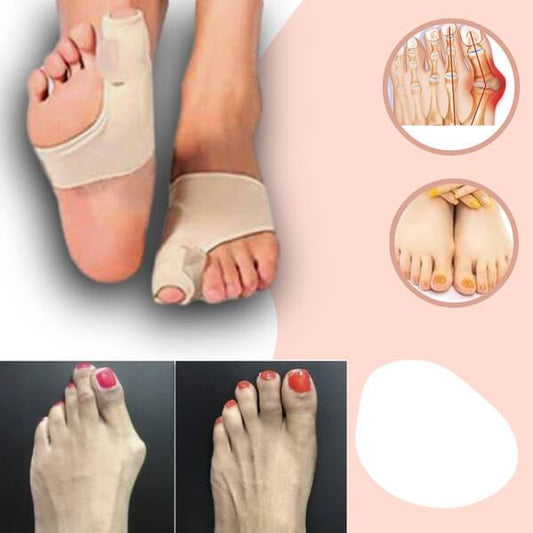 FeelGreat Orthopedic Toe Bunion Corrector - Summit MX Shop